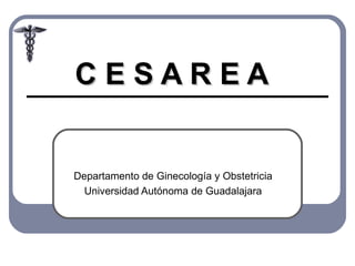 C E S A R E A Departamento de Ginecología y Obstetricia Universidad Autónoma de Guadalajara 