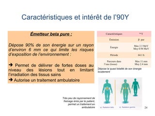 24
Caractéristiques et intérêt de l’90Y
Caractéristiques 90
Y
Émission β-
pur
Énergie
Max 2.3 MeV
Moy 0.94 MeV
Période 64.1 h
Parcours dans
l’eau (tissus)
Max 11 mm
Moy 2.4 mm
Rougier. Barcelone 2010
Émetteur beta pure :
Dépose 90% de son énergie sur un rayon
d’environ 6 mm ce qui limite les risques
d’exposition de l’environnement :
 Permet de délivrer de fortes doses au
niveau des lésions tout en limitant
l’irradiation des tissus sains
 Autorise un traitement ambulatoire
Dépose la quasi totalité de son énergie
localement
Très peu de rayonnement de
freinage émis par le patient,
permet un traitement en
ambulatoire
 