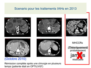 (Octobre 2010)
Rémission complète après une chirurgie en plusieurs
temps (patiente était en OPTILIV07)
MHCCRs
(Théoriquement)
probablement
jamais
résécable
Scenario pour les traitements IAHs en 2013
 