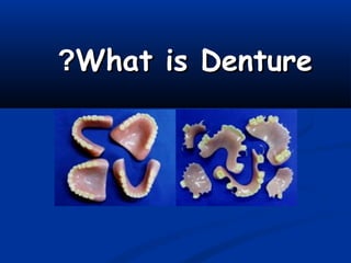 What is DentureWhat is Denture??
 