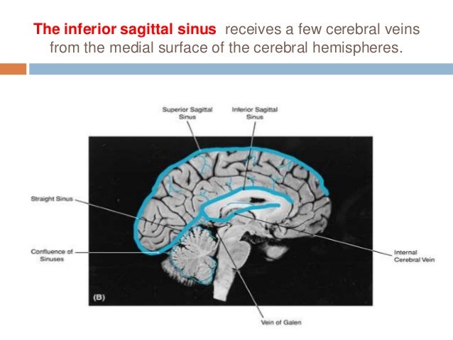 15 Dural Venous Sinuses