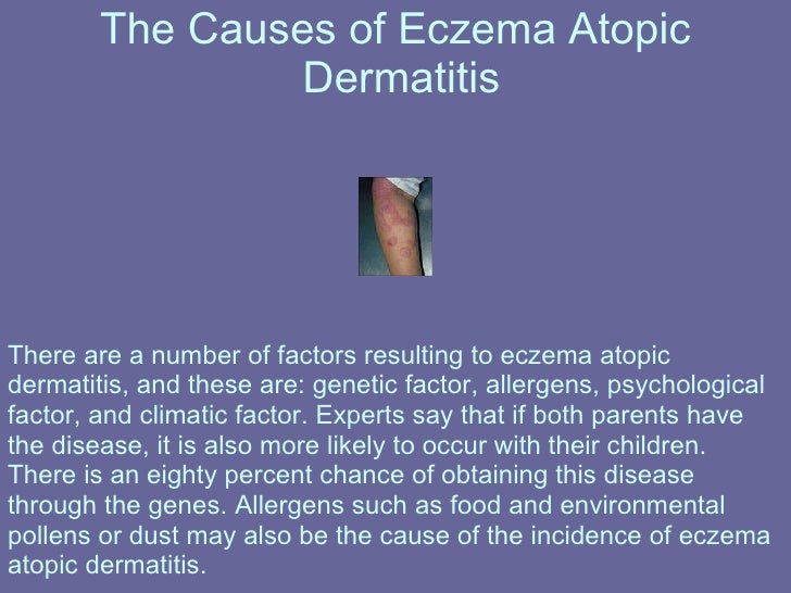 Eczema Atopic Dermatitis The Causes And Treatment