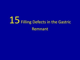 15Filling Defects in the Gastric
Remnant
 