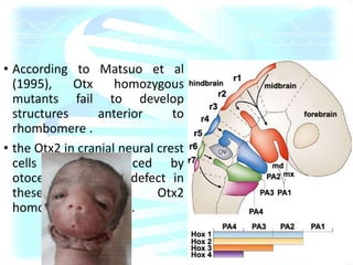 • According to Matsuo et al
(1995), Otx homozygous
mutants fail to develop
structures anterior to
rhombomere .
• the Otx2 in cranial neural crest
cells was evidenced by
otocephaly due to defect in
these cells of Otx2
homozygous mutants.
 