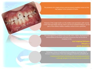 The presence of a single primary and permanent maxillary incisor at first
may appear to be a product of fusion.
However, if the single tooth is in the midline and symmetric with normal
crown and root shape and size, then it can be an isolated finding or can be
part of the solitary median maxillary central incisor syndrome.
This heterogeneous condition may include other midline developmental
abnormalities of the brain and other structures that can be due to
mutation in the
sonic hedgehog (SHH) gene,
SIX3 gene, or
genetic abnormality.
Following a review of published family pedigrees involving Class II,
Division 2 malocclusion, Peck and colleagues noted the probability of
• autosomal dominant inheritance with incomplete penetrance,
• although polygenic inheritance was also a possibility.
 