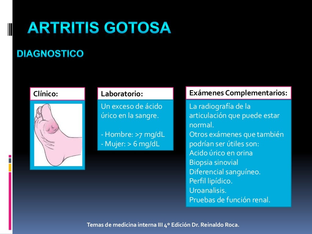 Artritis Gotosa