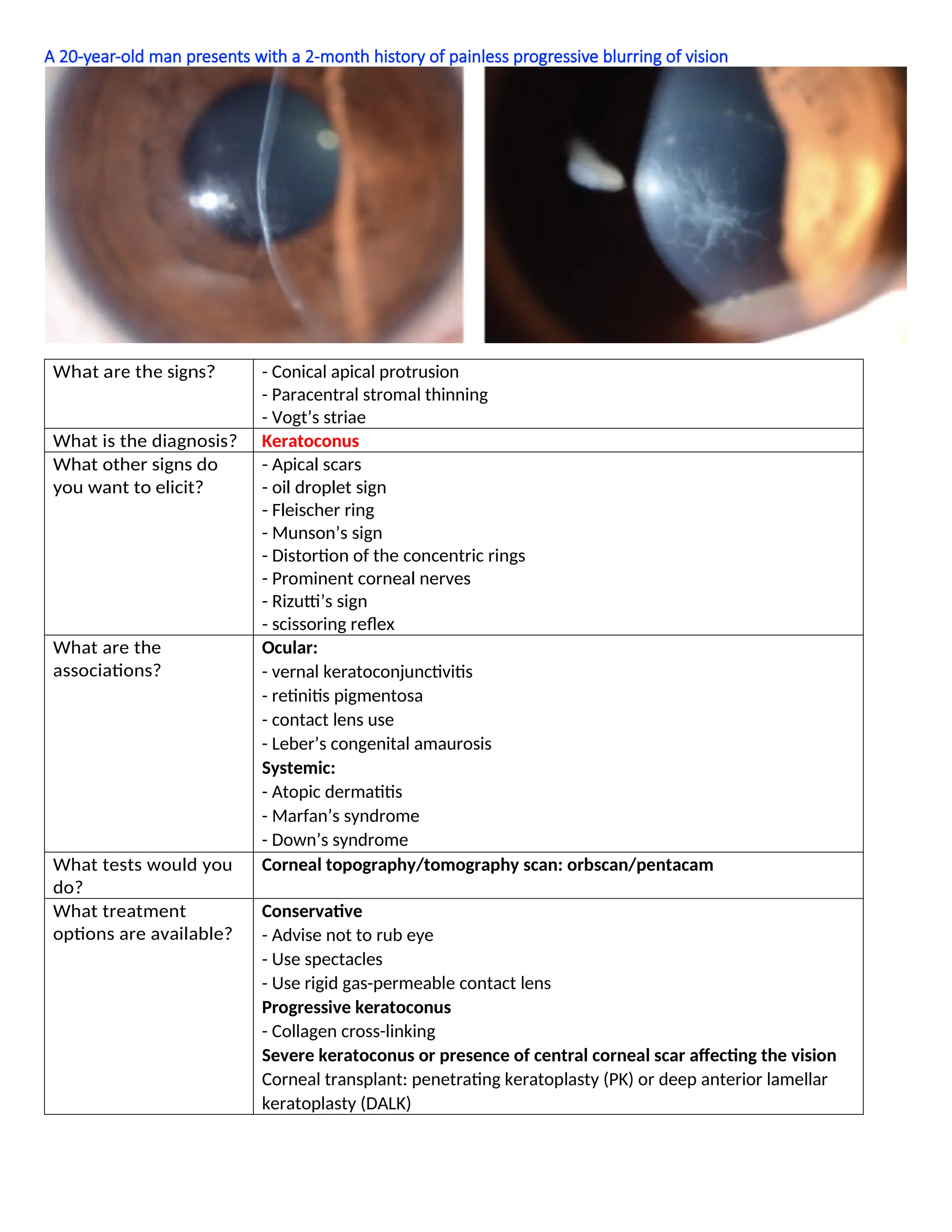 A 20-year-old man presents with a 2-month history of painless progressive blurring of vision
What are the signs? - Conical apical protrusion
- Paracentral stromal thinning
- Vogt’s striae
What is the diagnosis? Keratoconus
What other signs do
you want to elicit?
- Apical scars
- oil droplet sign
- Fleischer ring
- Munson’s sign
- Distortion of the concentric rings
- Prominent corneal nerves
- Rizutti’s sign
- scissoring reflex
What are the
associations?
Ocular:
- vernal keratoconjunctivitis
- retinitis pigmentosa
- contact lens use
- Leber’s congenital amaurosis
Systemic:
- Atopic dermatitis
- Marfan’s syndrome
- Down’s syndrome
What tests would you
do?
Corneal topography/tomography scan: orbscan/pentacam
What treatment
options are available?
Conservative
- Advise not to rub eye
- Use spectacles
- Use rigid gas-permeable contact lens
Progressive keratoconus
- Collagen cross-linking
Severe keratoconus or presence of central corneal scar affecting the vision
Corneal transplant: penetrating keratoplasty (PK) or deep anterior lamellar
keratoplasty (DALK)
 