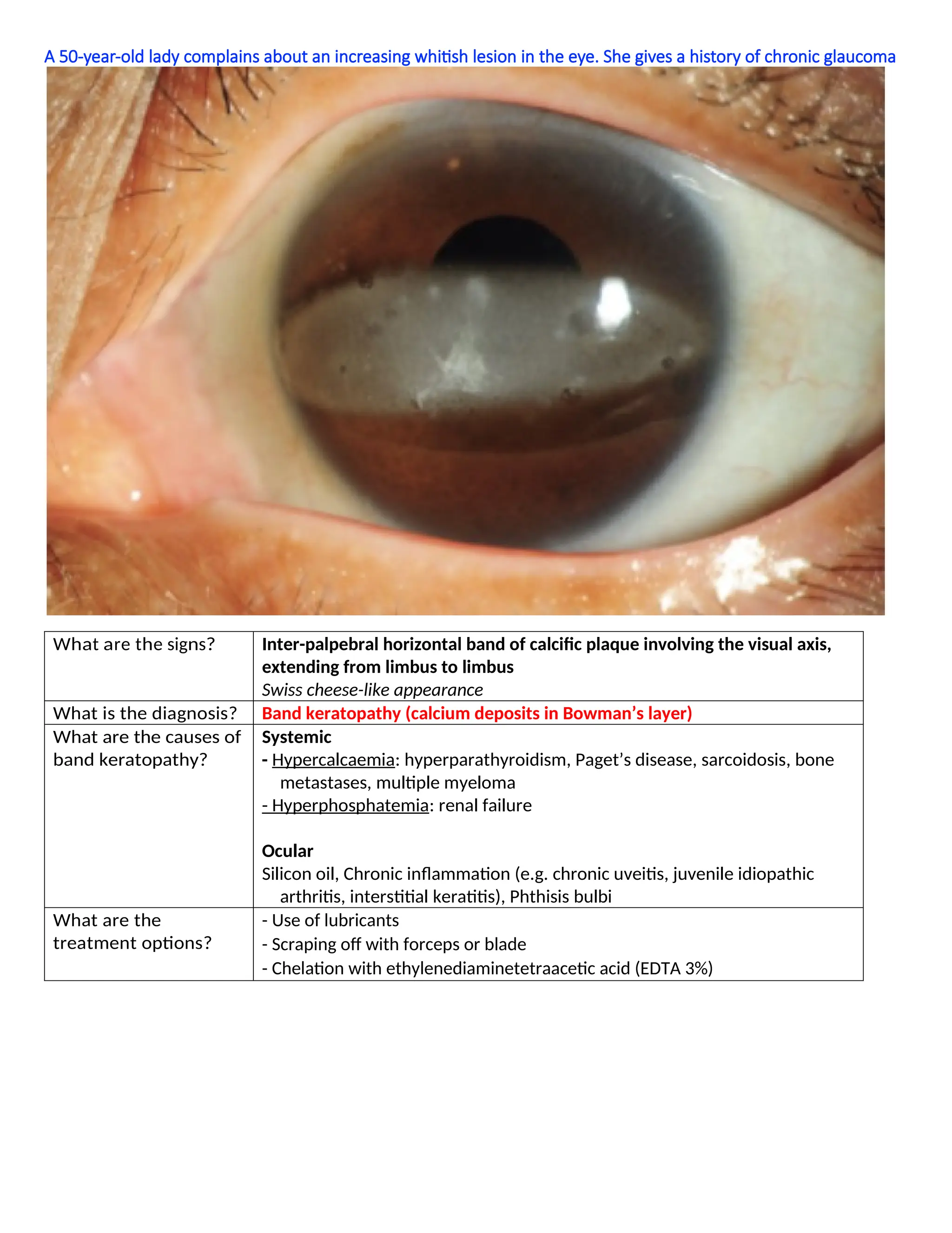 A 50-year-old lady complains about an increasing whitish lesion in the eye. She gives a history of chronic glaucoma
What are the signs? Inter-palpebral horizontal band of calcific plaque involving the visual axis,
extending from limbus to limbus
Swiss cheese-like appearance
What is the diagnosis? Band keratopathy (calcium deposits in Bowman’s layer)
What are the causes of
band keratopathy?
Systemic
- Hypercalcaemia: hyperparathyroidism, Paget’s disease, sarcoidosis, bone
metastases, multiple myeloma
- Hyperphosphatemia: renal failure
Ocular
Silicon oil, Chronic inflammation (e.g. chronic uveitis, juvenile idiopathic
arthritis, interstitial keratitis), Phthisis bulbi
What are the
treatment options?
- Use of lubricants
- Scraping off with forceps or blade
- Chelation with ethylenediaminetetraacetic acid (EDTA 3%)
 
