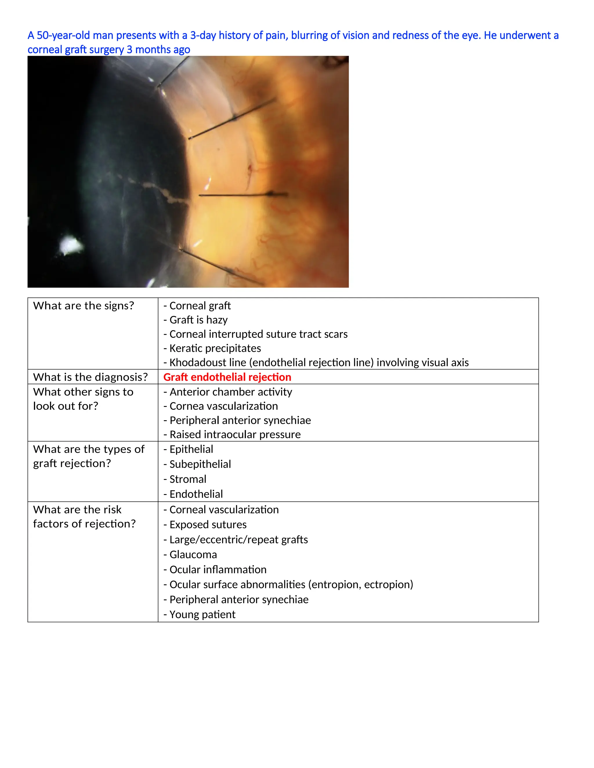 A 50-year-old man presents with a 3-day history of pain, blurring of vision and redness of the eye. He underwent a
corneal graft surgery 3 months ago
What are the signs? - Corneal graft
- Graft is hazy
- Corneal interrupted suture tract scars
- Keratic precipitates
- Khodadoust line (endothelial rejection line) involving visual axis
What is the diagnosis? Graft endothelial rejection
What other signs to
look out for?
- Anterior chamber activity
- Cornea vascularization
- Peripheral anterior synechiae
- Raised intraocular pressure
What are the types of
graft rejection?
- Epithelial
- Subepithelial
- Stromal
- Endothelial
What are the risk
factors of rejection?
- Corneal vascularization
- Exposed sutures
- Large/eccentric/repeat grafts
- Glaucoma
- Ocular inflammation
- Ocular surface abnormalities (entropion, ectropion)
- Peripheral anterior synechiae
- Young patient
 