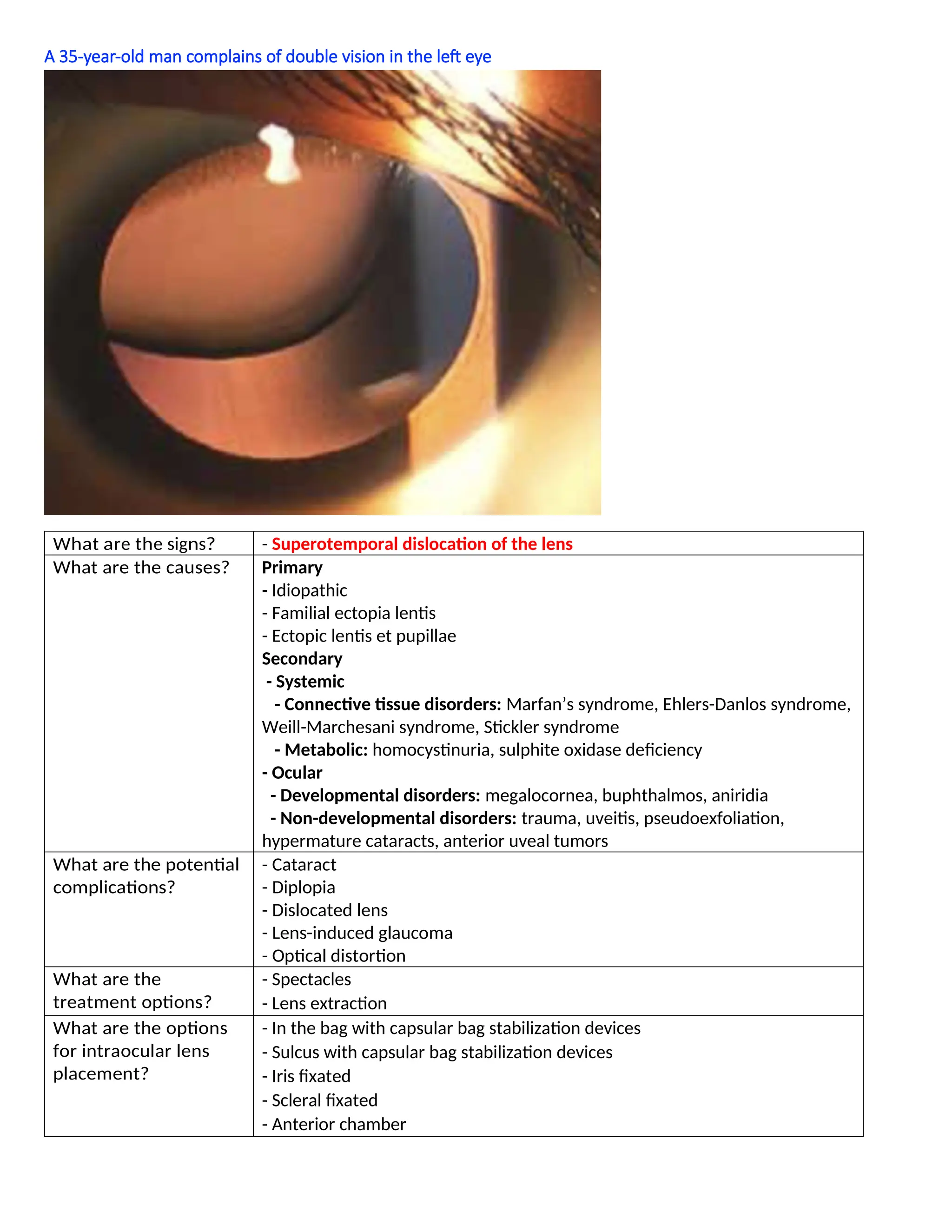 A 35-year-old man complains of double vision in the left eye
What are the signs? - Superotemporal dislocation of the lens
What are the causes? Primary
- Idiopathic
- Familial ectopia lentis
- Ectopic lentis et pupillae
Secondary
- Systemic
- Connective tissue disorders: Marfan’s syndrome, Ehlers-Danlos syndrome,
Weill-Marchesani syndrome, Stickler syndrome
- Metabolic: homocystinuria, sulphite oxidase deficiency
- Ocular
- Developmental disorders: megalocornea, buphthalmos, aniridia
- Non-developmental disorders: trauma, uveitis, pseudoexfoliation,
hypermature cataracts, anterior uveal tumors
What are the potential
complications?
- Cataract
- Diplopia
- Dislocated lens
- Lens-induced glaucoma
- Optical distortion
What are the
treatment options?
- Spectacles
- Lens extraction
What are the options
for intraocular lens
placement?
- In the bag with capsular bag stabilization devices
- Sulcus with capsular bag stabilization devices
- Iris fixated
- Scleral fixated
- Anterior chamber
 