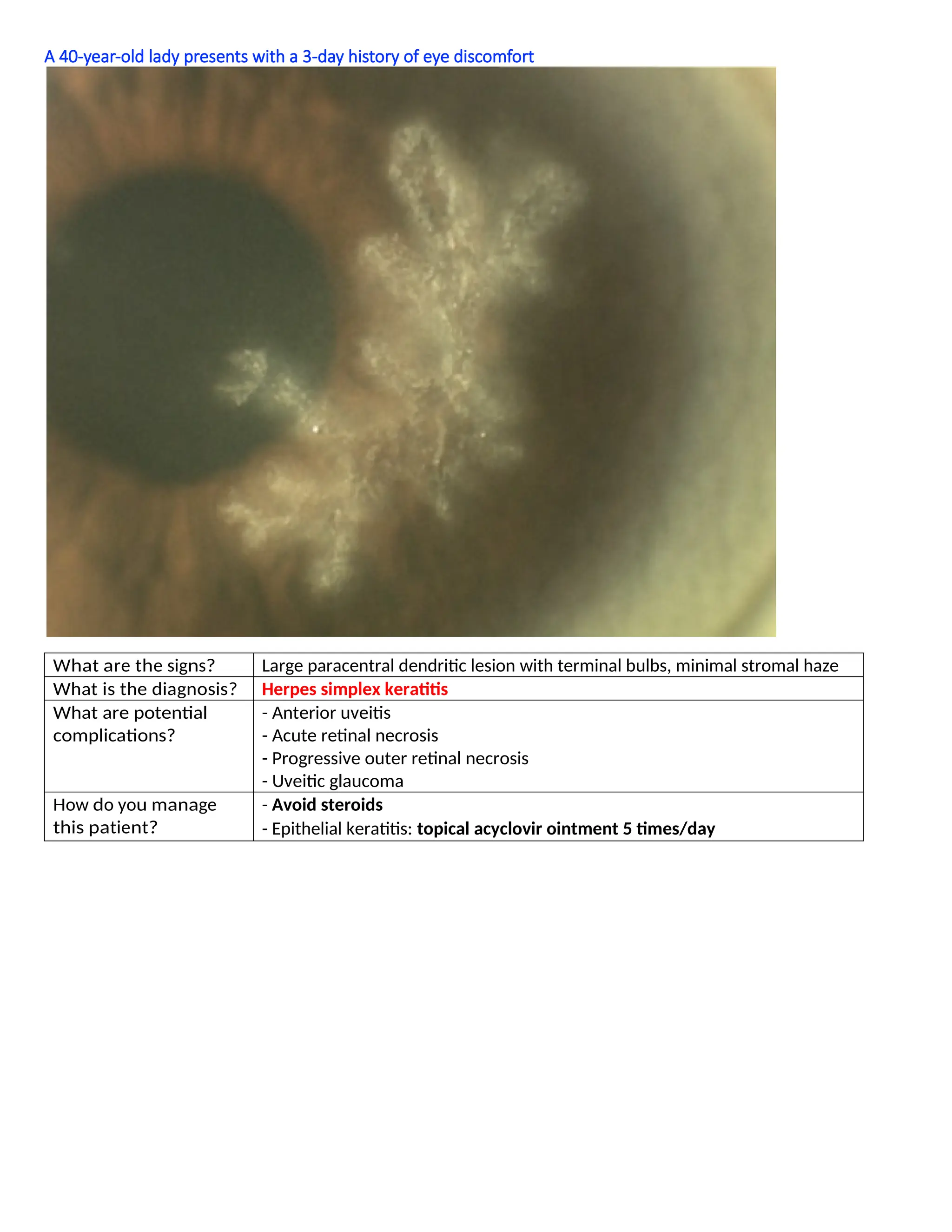 A 40-year-old lady presents with a 3-day history of eye discomfort
What are the signs? Large paracentral dendritic lesion with terminal bulbs, minimal stromal haze
What is the diagnosis? Herpes simplex keratitis
What are potential
complications?
- Anterior uveitis
- Acute retinal necrosis
- Progressive outer retinal necrosis
- Uveitic glaucoma
How do you manage
this patient?
- Avoid steroids
- Epithelial keratitis: topical acyclovir ointment 5 times/day
 