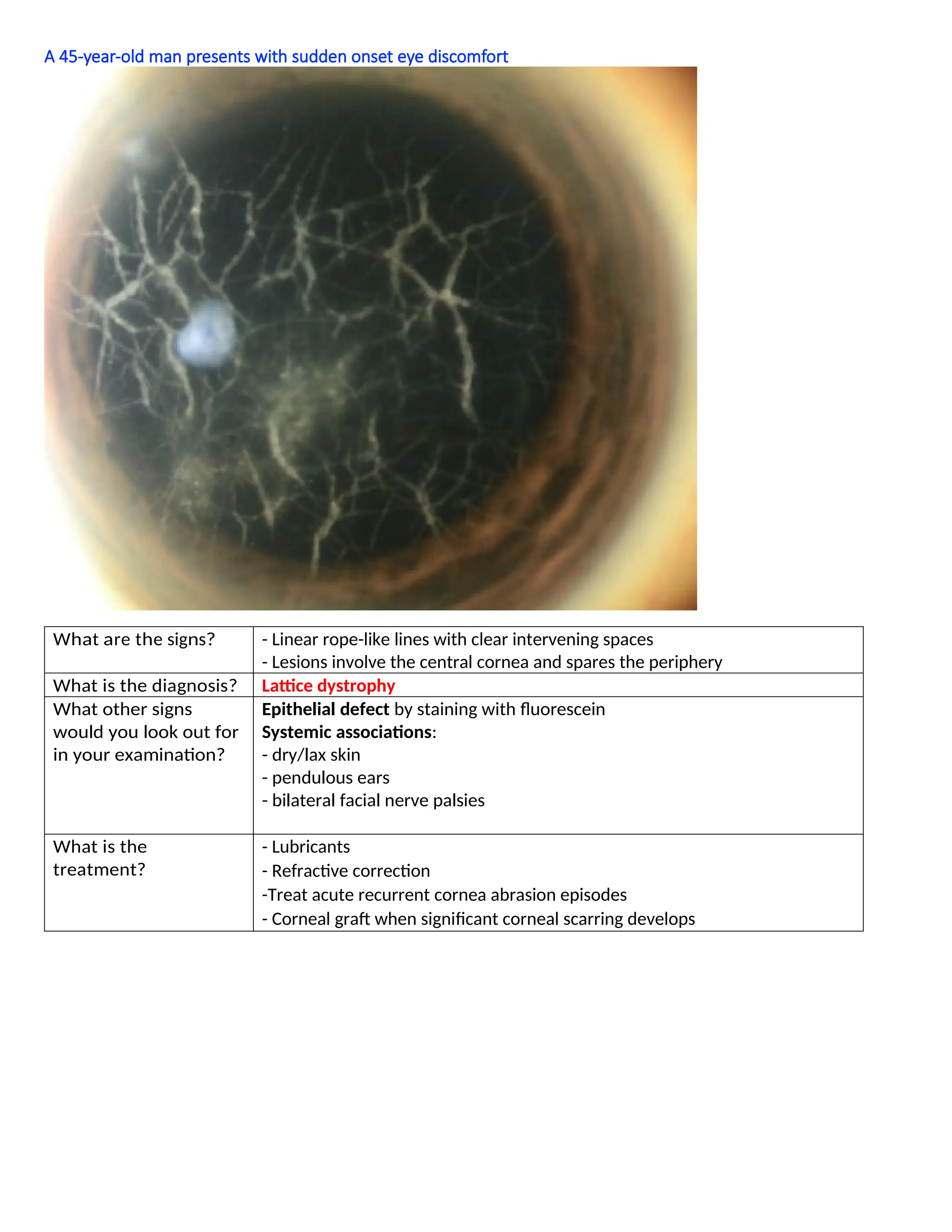 A 45-year-old man presents with sudden onset eye discomfort
What are the signs? - Linear rope-like lines with clear intervening spaces
- Lesions involve the central cornea and spares the periphery
What is the diagnosis? Lattice dystrophy
What other signs
would you look out for
in your examination?
Epithelial defect by staining with fluorescein
Systemic associations:
- dry/lax skin
- pendulous ears
- bilateral facial nerve palsies
What is the
treatment?
- Lubricants
- Refractive correction
-Treat acute recurrent cornea abrasion episodes
- Corneal graft when significant corneal scarring develops
 