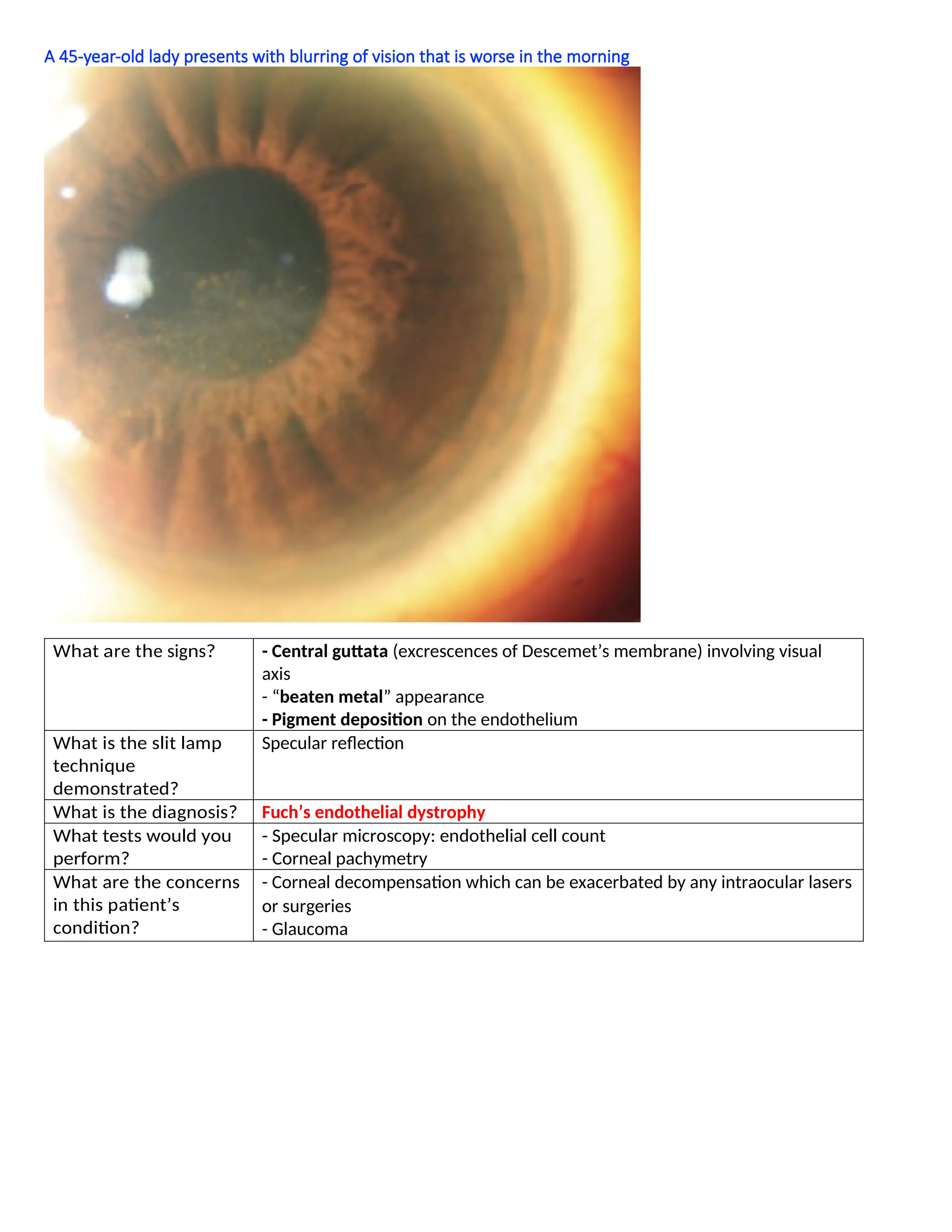 A 45-year-old lady presents with blurring of vision that is worse in the morning
What are the signs? - Central guttata (excrescences of Descemet’s membrane) involving visual
axis
- “beaten metal” appearance
- Pigment deposition on the endothelium
What is the slit lamp
technique
demonstrated?
Specular reflection
What is the diagnosis? Fuch’s endothelial dystrophy
What tests would you
perform?
- Specular microscopy: endothelial cell count
- Corneal pachymetry
What are the concerns
in this patient’s
condition?
- Corneal decompensation which can be exacerbated by any intraocular lasers
or surgeries
- Glaucoma
 
