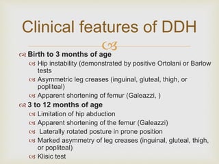 Clinical features of DDH 
 
 Birth to 3 months of age 
 Hip instability (demonstrated by positive Ortolani or Barlow 
tests 
 Asymmetric leg creases (inguinal, gluteal, thigh, or 
popliteal) 
 Apparent shortening of femur (Galeazzi, ) 
 3 to 12 months of age 
 Limitation of hip abduction 
 Apparent shortening of the femur (Galeazzi) 
 Laterally rotated posture in prone position 
 Marked asymmetry of leg creases (inguinal, gluteal, thigh, 
or popliteal) 
 Klisic test 
 