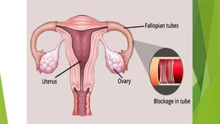 15 Reproduction human and puberty of teenager | PPTX