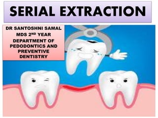 SERIAL EXTRACTION
DR SANTOSHNI SAMAL
MDS 2ND YEAR
DEPARTMENT OF
PEDODONTICS AND
PREVENTIVE
DENTISTRY
 