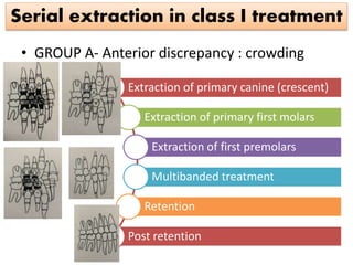 Serial extraction in class I treatment
• GROUP A- Anterior discrepancy : crowding
Extraction of primary canine (crescent)
Extraction of primary first molars
Extraction of first premolars
Multibanded treatment
Retention
Post retention
 
