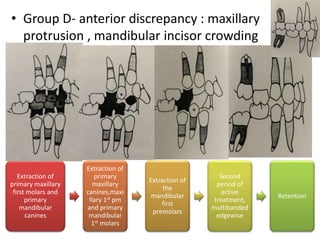 • Group D- anterior discrepancy : maxillary
protrusion , mandibular incisor crowding
Extraction of
primary maxillary
first molars and
primary
mandibular
canines
Extraction of
primary
maxillary
canines,maxi
llary 1st pm
and primary
mandibular
1st molars
Extraction of
the
mandibular
first
premolars
Second
period of
active
treatment,
multibanded
edgewise
Retention
 