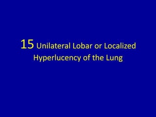 15Unilateral Lobar or Localized
Hyperlucency of the Lung
 