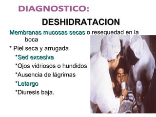 DESHIDRATACIONDESHIDRATACION
Membranas mucosas secasMembranas mucosas secas o resequedad en la
boca
* Piel seca y arrugada
*Sed excesivaSed excesiva
*Ojos vidriosos o hundidos
*Ausencia de lágrimas
*LetargoLetargo
*Diuresis baja.
 