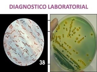 MUESTRA EXAMENDIRECTO CULTIVO
Vómitos
Hecesdiarrecas
BaciloGram
negativosenforma
de“C”o“S”
AgarTCBS
 