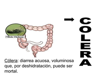 Cólera: diarrea acuosa, voluminosa
que, por deshidratación, puede ser
mortal.
 