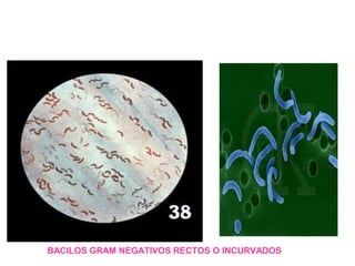 BACILOS GRAM NEGATIVOS RECTOS O INCURVADOS
 