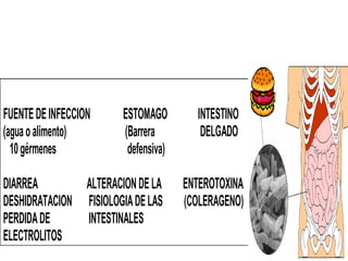 FUENTEDEINFECCION ESTOMAGO INTESTINO
(aguaoalimento) (Barrera DELGADO
10gérmenes defensiva)
DIARREA ALTERACIONDELA ENTEROTOXINA
DESHIDRATACION FISIOLOGIADELAS (COLERAGENO)
PERDIDADE INTESTINALES
ELECTROLITOS
 