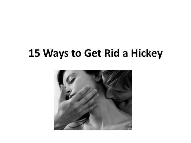 Can you get rid of a hickey with a penny?