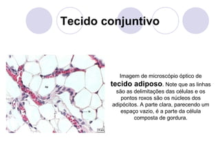 Tecido conjuntivo

Imagem de microscópio óptico de

tecido adiposo. Note que as linhas
são as delimitações das células e os
pontos roxos são os núcleos dos
adipócitos. A parte clara, parecendo um
espaço vazio, é a parte da célula
composta de gordura.

 