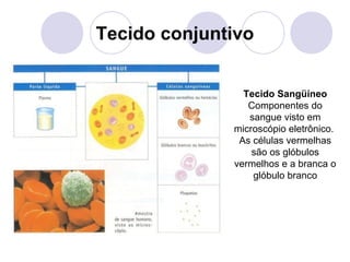 Tecido conjuntivo
Tecido Sangüíneo
Componentes do
sangue visto em
microscópio eletrônico.
As células vermelhas
são os glóbulos
vermelhos e a branca o
glóbulo branco

 