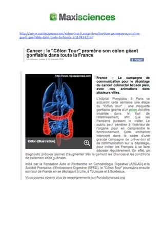  
 
 
http://www.maxisciences.com/colon‐tour/cancer‐le‐colon‐tour‐promene‐son‐colon‐
geant‐gonflable‐dans‐toute‐la‐france_art10434.html 
 
 
 
 
 
 