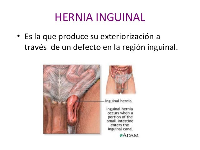 El ungüento que anestesia a los dolores en la espalda y los músculos