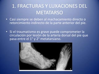 1. FRACTURAS Y LUXACIONES DEL
METATARSO
• Casi siempre se deben al machacamiento directo o
retorcimiento indirecto de la parte anterior del pie.
• Si el traumatismo es grave puede comprometer la
circulación por lesión de la arteria dorsal del pie que
pasa entre el 1° y 2° metatarsiano.
 