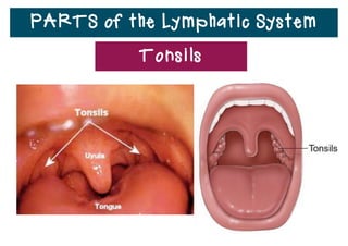 Lymph Diseases and Disorders
• Damage to the lymphatic system from injury or surgery
can keep tissue ﬂuid from draining into lymph vessels.
• Tissue ﬂuid can build up around cells and cause swelling.
• Lack of activity can also cause
swelling.
• When the muscles do not push
lymph through the lymph
vessels, lymph can build up.
 