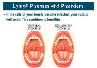 Lymph Diseases and Disorders
 