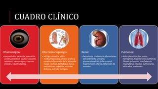 CUADRO CLÍNICO
Oftalmológico:
•conjuntivitis, escleritis, queratitis,
uveítis, proptosis ocular, vasculitis
retiniana, hemorragias, cuerpos
citoides, neuritis óptica.
Otorrinolaringología:
•vértigo, sinusitis, otitis
media,hipoacusia,úlceras orales y
nasales,inflamación de la pirámide
nasal, necrosis del tabique nasal,
condritis del pabellón auricular,
disfonía, estridor laríngeo.
Renal:
•hematuria, proteinuria,alteraciones
del sedimento urinario,
glomerulonefritis, infarto renal,
hipertensión arterial, retención de
azoados.
Pulmones:
•dolor pleurítico, tos, asma,
hemoptisis, hipertensión pulmonar,
fibrosis pulmonar, insuficiencia
respiratoria, nódulos pulmonares,
infiltrados, cavidades.
 