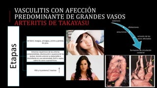 VASCULITIS CON AFECCIÓN
PREDOMINANTE DE GRANDES VASOS
ARTERITIS DE TAKAYASU
Etapas
SX febril, mialgias, artralgias, artritis y pérdida
de peso.
Síntomas isquémicos de las arterias
comprometidas, disminución o ausencia de los
pulsos, tensión arterial no detectable o
discordante en una extremidad, thrill o soplos
sobre los vasos supraaórticos.
VSG y la proteina C reactiva
estenosis
dilataciones
aneurismas
oclusión de los
vasos afectados
formación de circulación
colateral
 