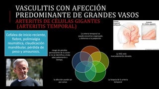 VASCULITIS CON AFECCIÓN
PREDOMINANTE DE GRANDES VASOS
ARTERITIS DE CÉLULAS GIGANTES
(ARTERITIS TEMPORAL)
La arteria temporal se
puede encontrar engrosada
y dolorosa a la palpación.
La VSG está
marcadamente elevada.
La biopsia de la arteria
temporal
la afección puede ser
por zonas
riesgo de pérdida
permanente de la visión
si no se identifica y trata
adecuadamente a
tiempo.
Cefalea de inicio reciente,
fiebre, polimialgia
reumática, claudicación
mandibular, pérdida de
peso y amaurosis.
 
