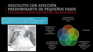 VASCULITIS CON AFECCIÓN
PREDOMINANTE DE PEQUEÑOS VASOS
POLIANGIÍTIS (POLIARTERITIS) MICROSCÓPICA
equivalente de la
poliarteritis nodosa
clásica
50-60 Años
LABORATORIALES:
p-ANCA o
MPOANCA en más
de 70% de los
casos,
La radiografía del
tórax puede revelar
infiltrados
intersticiales
difusos.
El diagnóstico se
confirma con
biopsia de los
tejidos
comprometidos.
MANIFESTACIONES: Fiebre, hiporexia,pérdida de
peso,artralgias,artritis,púrpura palpable, polineuropatía periférica,
dolor abdominal, hemoptisis,insuficiencia respiratoria y renal.
 