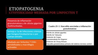 ETIOPATOGENIA
CITOTOXICIDAD MEDIADA POR LINFOCITOS T
Presencia de inflamación
granulomatosa y de células gigantes
multinucleadas.
Semeja a la de infecciones crónicas
por hongos/micobacterias o por
cuerpo extraño.
Mediado por linfocitos T CD4+
sensibilizados y macrófagos
activados
 
