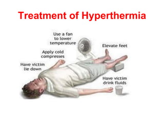 Treatment of Hyperthermia
 