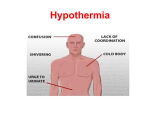 Hypothermia
 