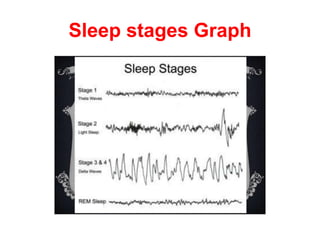 Sleep stages Graph
 