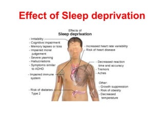 Effect of Sleep deprivation
 
