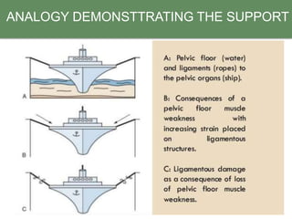 ANALOGY DEMONSTTRATING THE SUPPORT
 