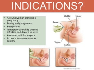 INDICATIONS?
 A young woman planning a
pregnancy
 During early pregnancy
 Puerperium
 Temporary use while clearing
infection and decubitus ulcer
 A woman unfit for surgery
 In case a woman refuses for
surgery
 