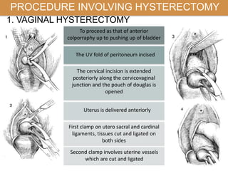 PROCEDURE INVOLVING HYSTERECTOMY
To proceed as that of anterior
colporraphy up to pushing up of bladder
The UV fold of peritoneum incised
The cervical incision is extended
posteriorly along the cervicovaginal
junction and the pouch of douglas is
opened
Uterus is delivered anteriorly
First clamp on utero sacral and cardinal
ligaments, tissues cut and ligated on
both sides
Second clamp involves uterine vessels
which are cut and ligated
1. VAGINAL HYSTERECTOMY
 