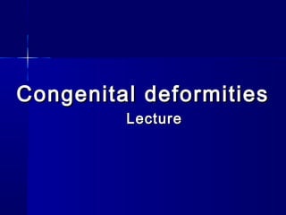 Congenital deformitiesCongenital deformities
LectureLecture
 