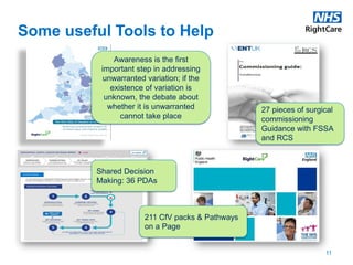 11
Some useful Tools to Help
Awareness is the first
important step in addressing
unwarranted variation; if the
existence of variation is
unknown, the debate about
whether it is unwarranted
cannot take place
Shared Decision
Making: 36 PDAs
27 pieces of surgical
commissioning
Guidance with FSSA
and RCS
211 CfV packs & Pathways
on a Page
 